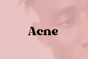 Acne Sensitive Skin