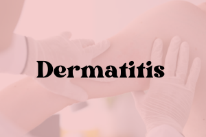 Dermatitis Sensitive Skin