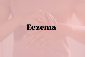 Eczema Sensitive Skin