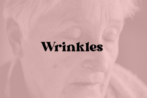 Wrinkles Sensitive Skin