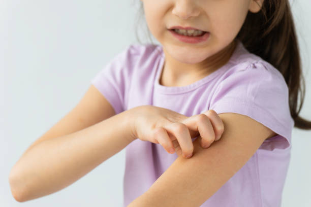 Sensible Skin Eczema Children