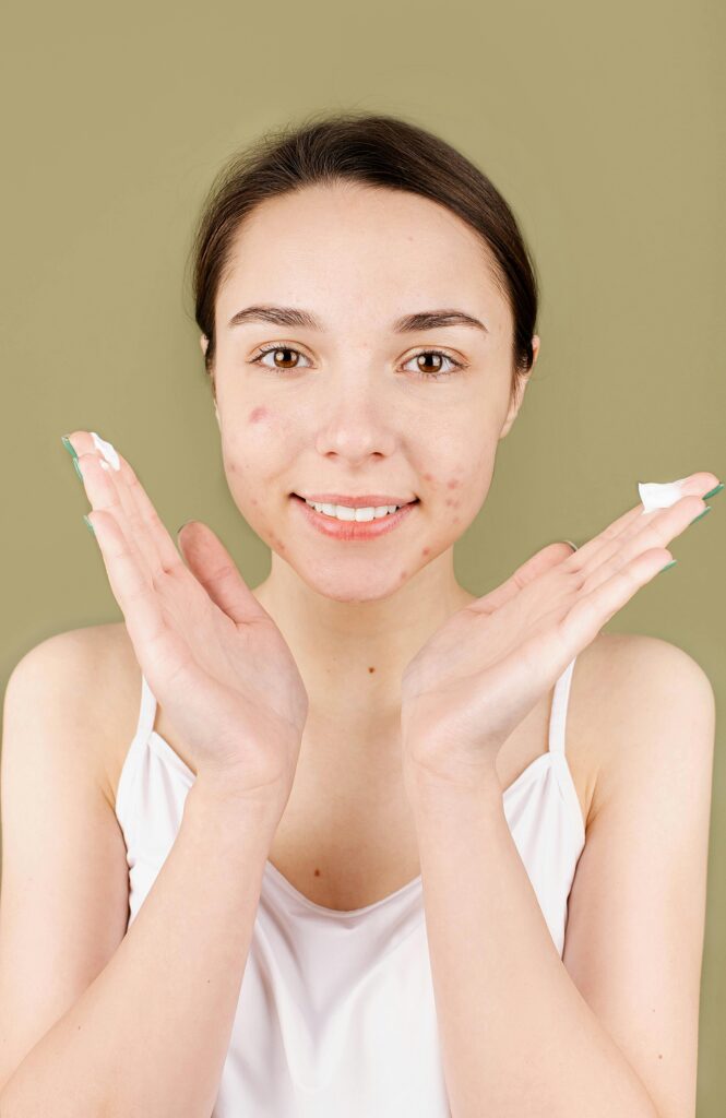 Sensitive Skin Acne-Prone